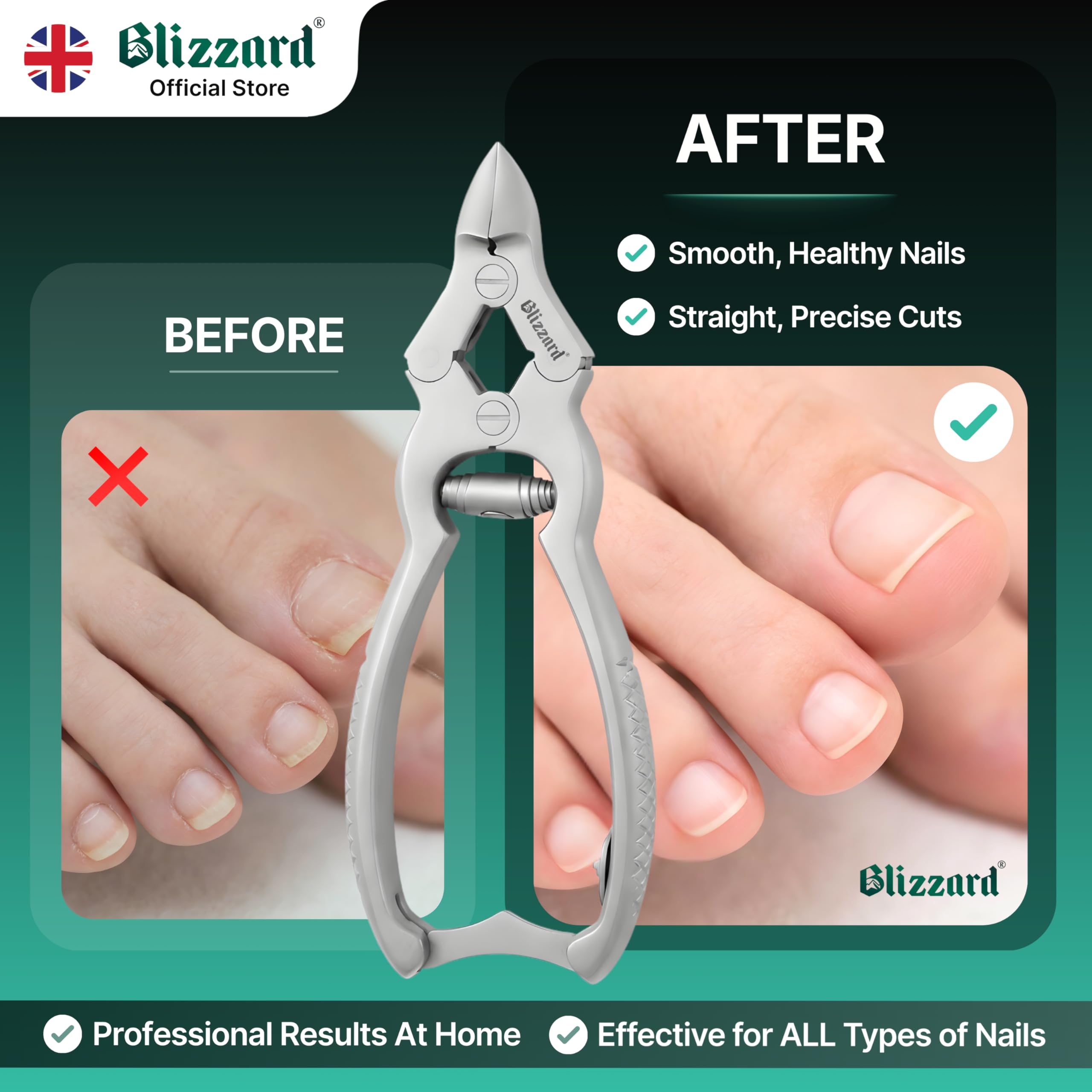 Blizzard Coupe-Ongles Professionnel pour Ongles Épais et Incarnés — Pince à Ongles Pieds Acier Inox - Seniors et Hommes - Idéal Pédicure et Soin des Pieds - Qualité Podologie - 15cm Ressort Barillet