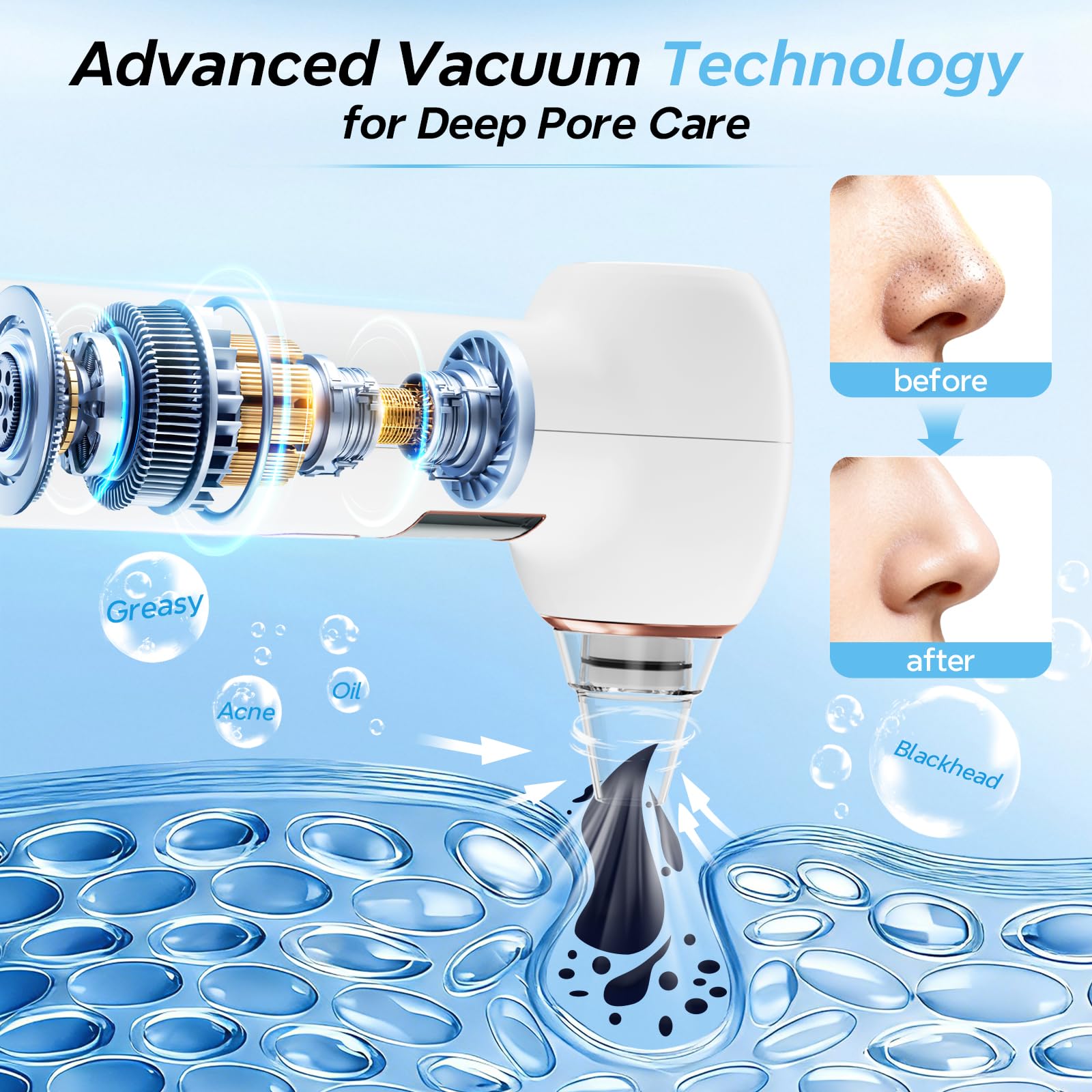 Aspirateur Point Noir Visage Extracteur de Point Noir et Tire Comédon pour Nez Appareil Anti Point Noir Nettoyage des Pores Blackhead Remover Rechargeable 5 Sondes 4 Modes - 4