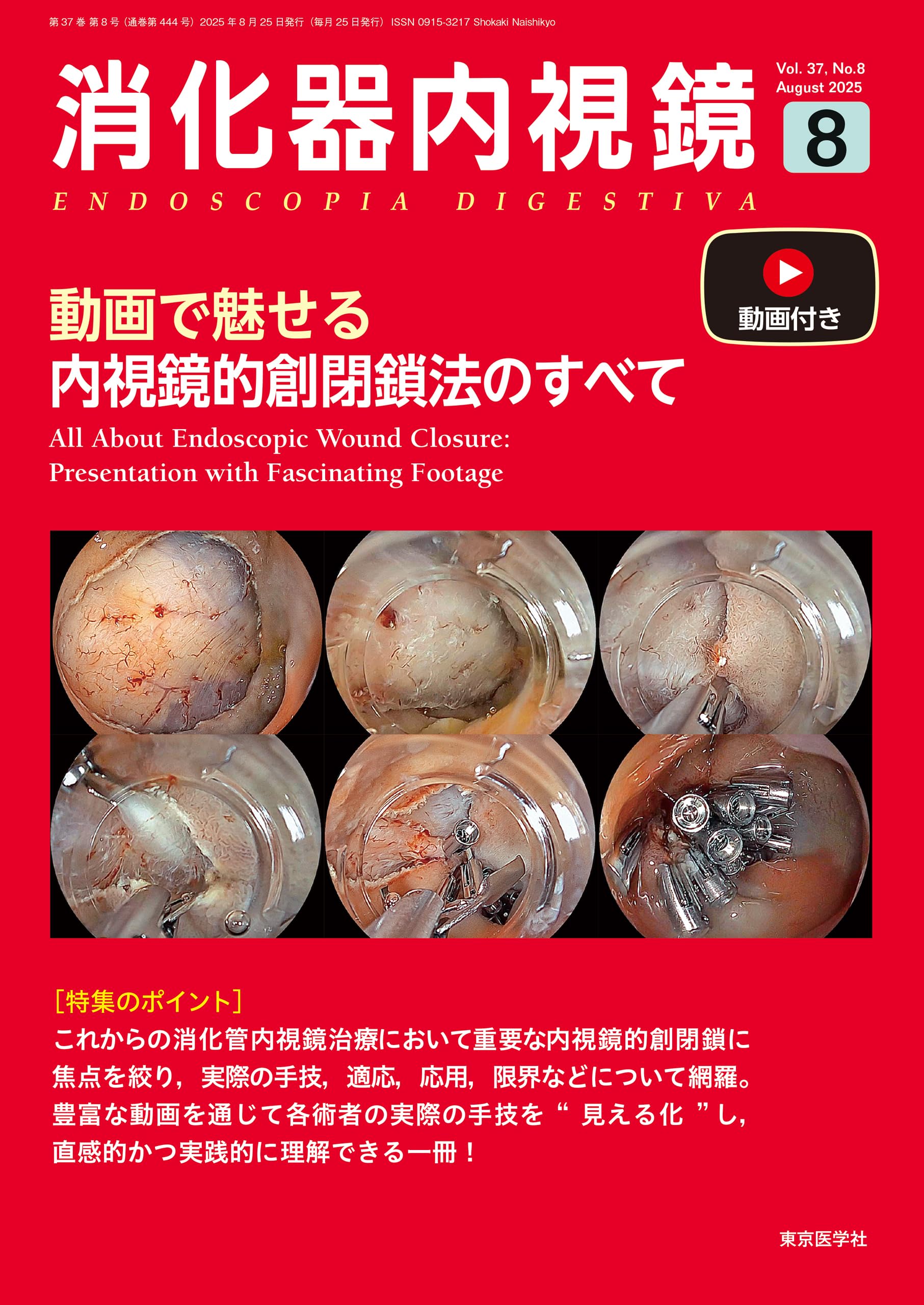 消化器内視鏡37巻8号（8月号） 動画で魅せる内視鏡的創閉鎖法の