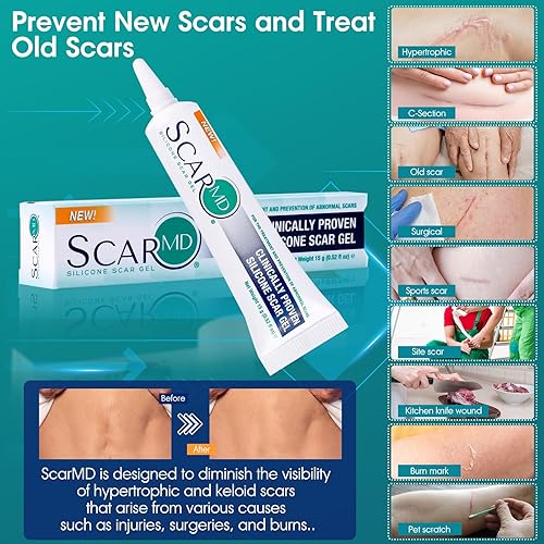 Miniatura 4 de ScarMD - Tratamiento de gel de silicona de grado médico, desvanece las cicatrices de la cirugía, sección C, cortes, quemaduras y más, tiene