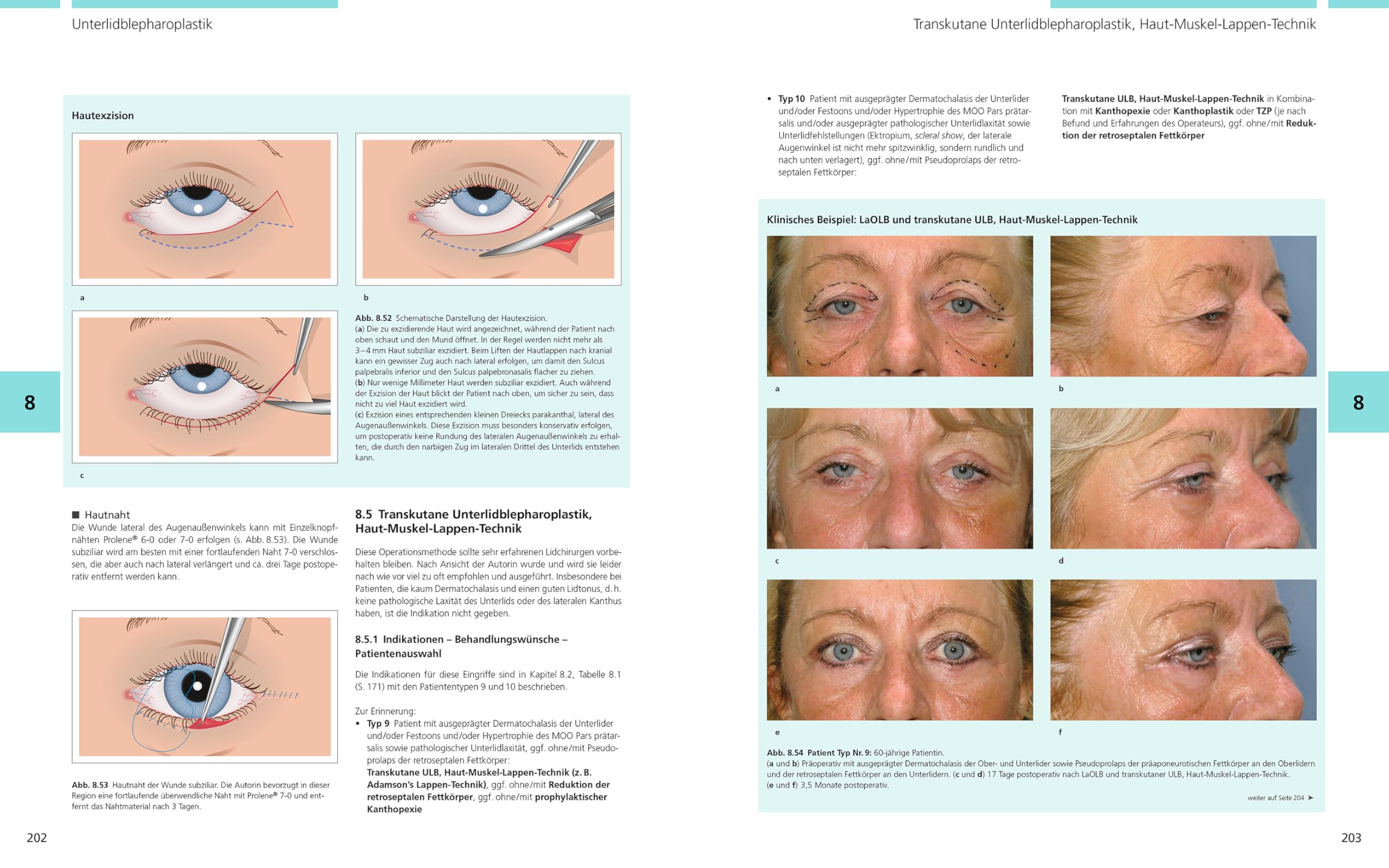 Bildatlas Lidchirurgie: Angewandte Anatomie | Untersuchung | Plastische Lidchirurgie