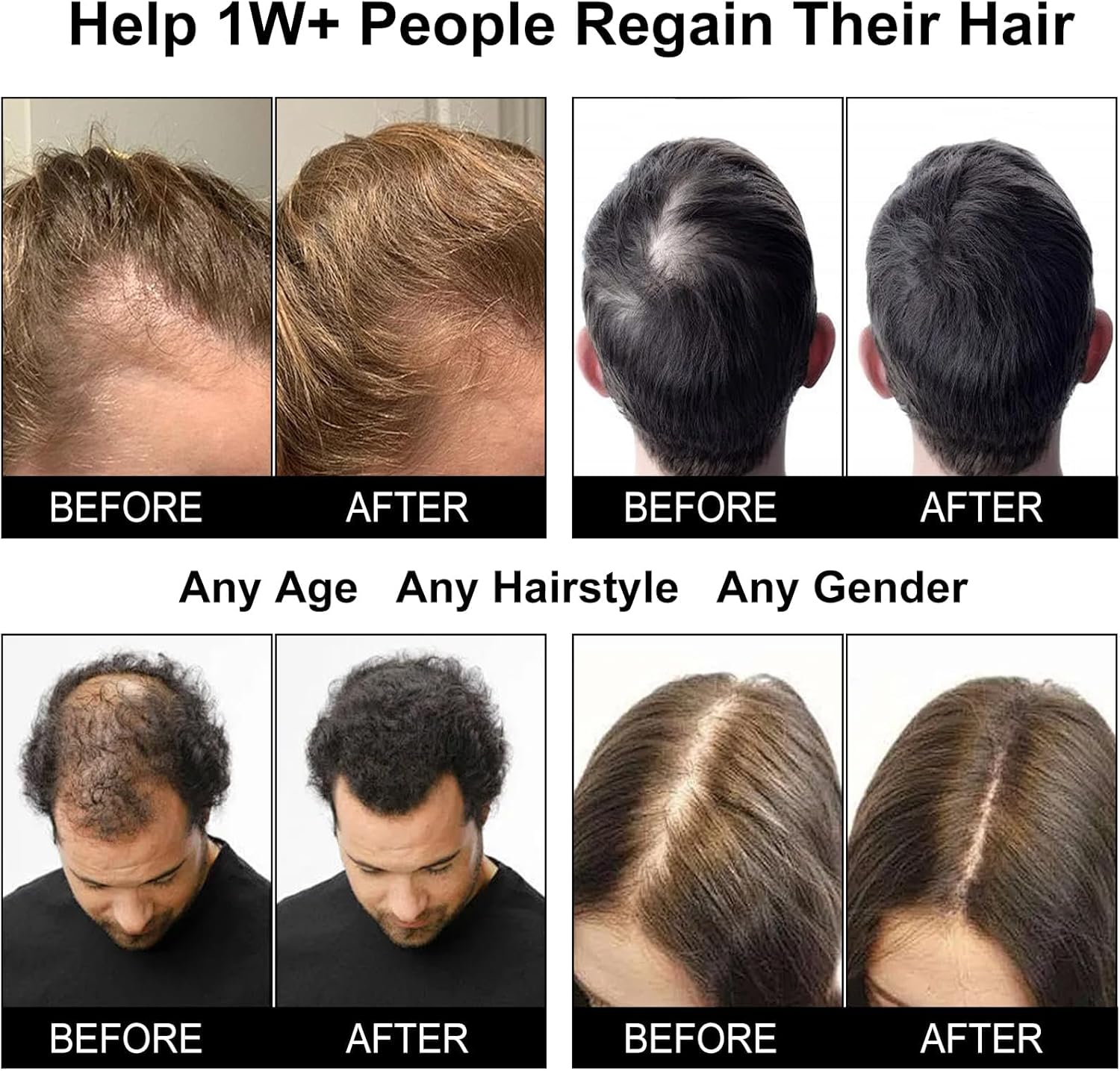 Red Light Therapy Hair Growth Cap, Laser Hair Growth Cap for Men and Women