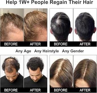 Red Light Therapy Hair Growth Cap, Laser Hair Growth Cap for Men and Women