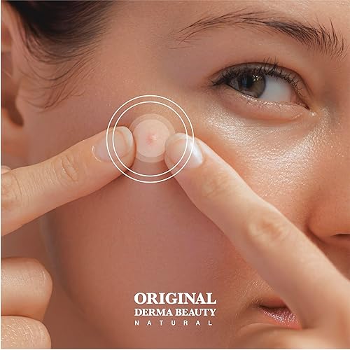 Miniatura 7 de 104 parches de espinillas, parches hidrocoloides para el acné para la cara (corazón 98 unidades)