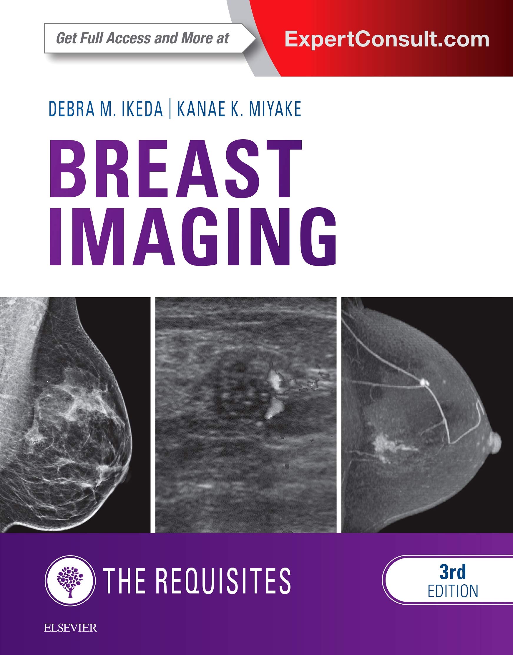 Breast Imaging: The Requisites (The Core Requisites) : Ikeda MD
