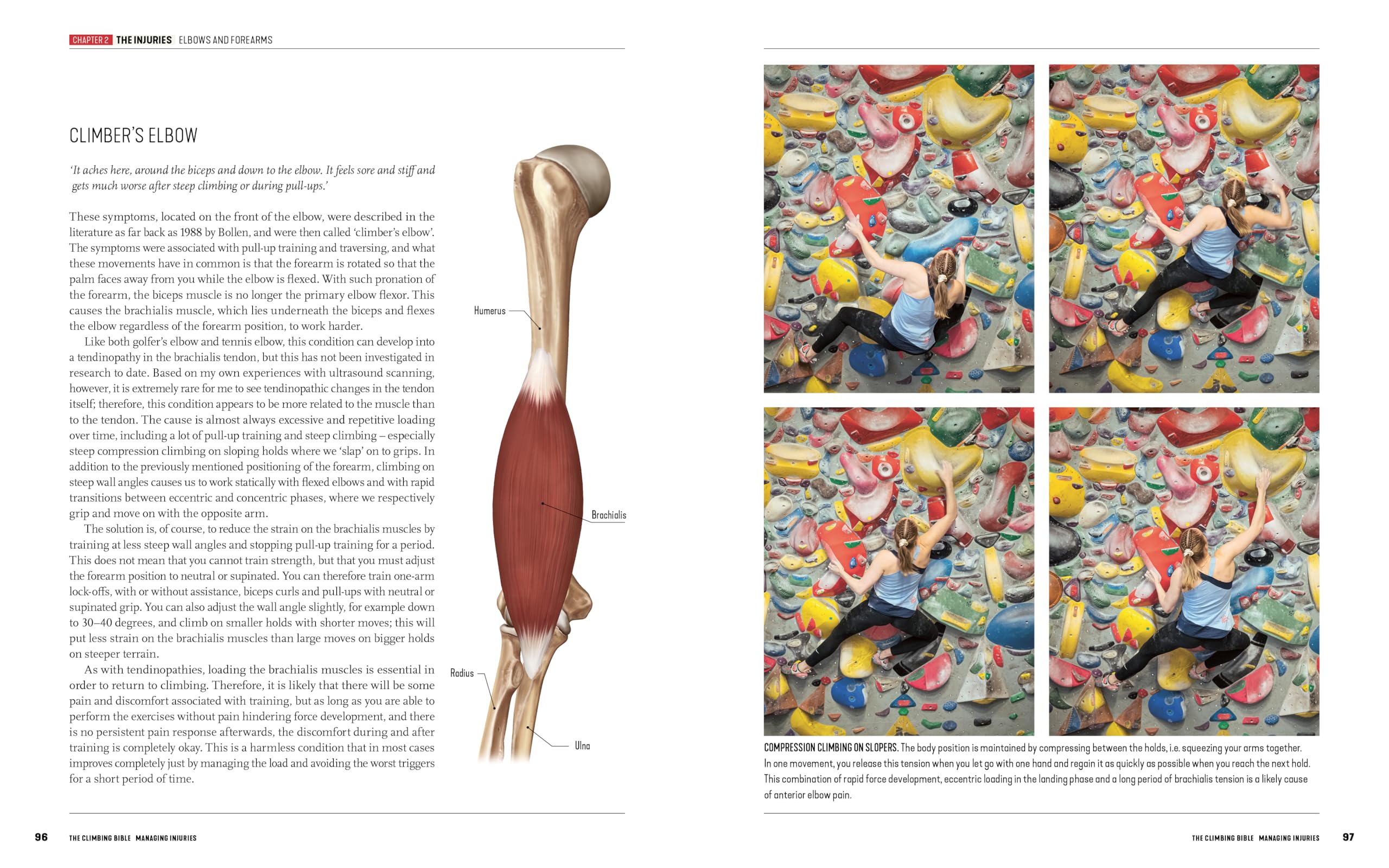 The Climbing Bible: Managing Injuries: Injury prevention and rehabilitation for climbing and bouldering: 3