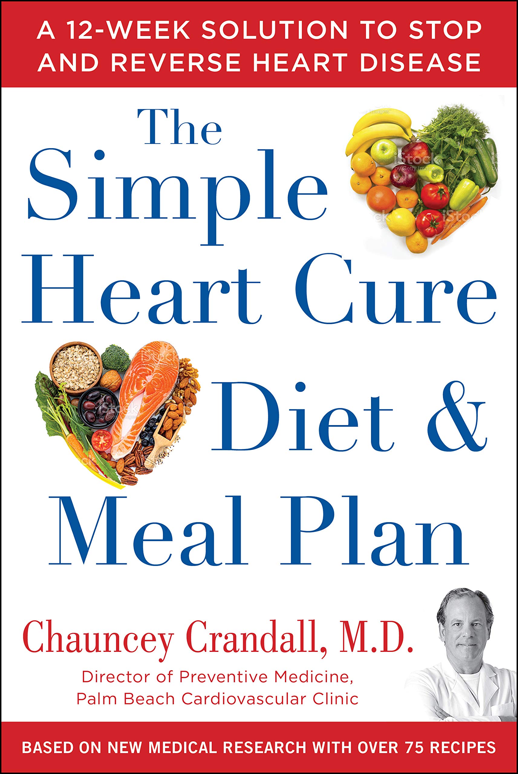 The Simple Heart Cure Diet and Meal Plan: 28 Days of Healthy Meals and Over 100 Delicious and Easy Recipes
