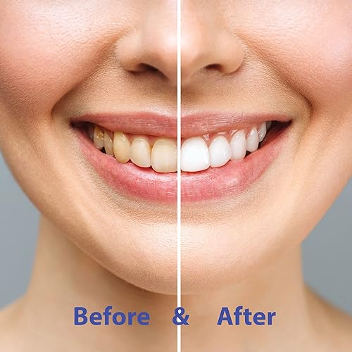 Miniatura 5 de Chomp Pastillas de pasta de dientes de canela súper blanqueadoras con recambio de nano hidroxiapatita