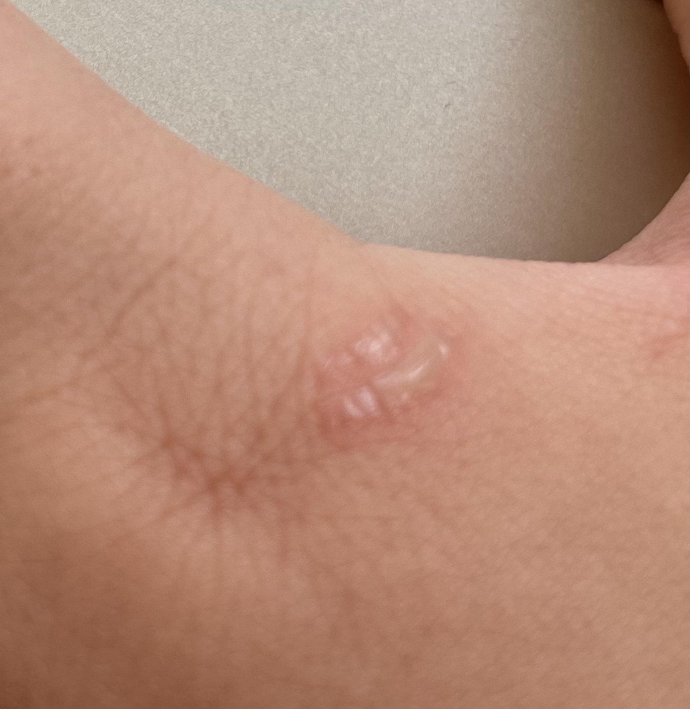 Verbrennungsgefahr! Besser nicht kaufen!!