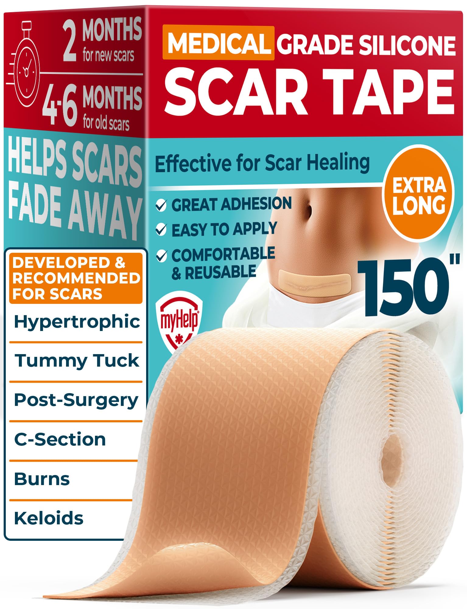 Medical Grade Silicone Scar Tape - 1.6"x150" - Effective Scar Removal 150"x1.6" Beige