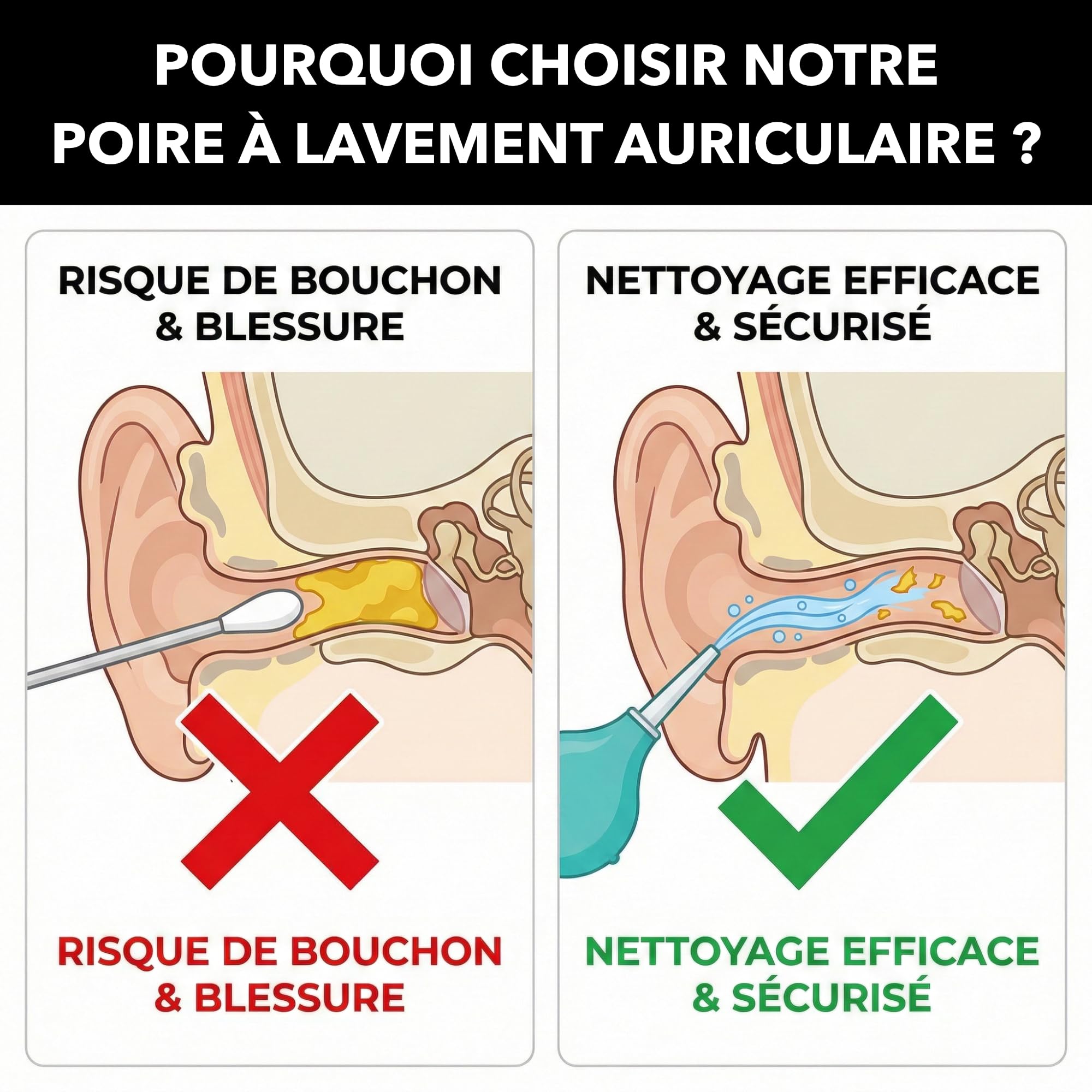 Poire Lavement Oreilles 75ml Haute Précision - Seringue Auriculaire Souple pour Nettoyage du Cérumen - Retrait de Bouchon d'Oreille - Embout Transparent Amovible - Matériau TPE Médical