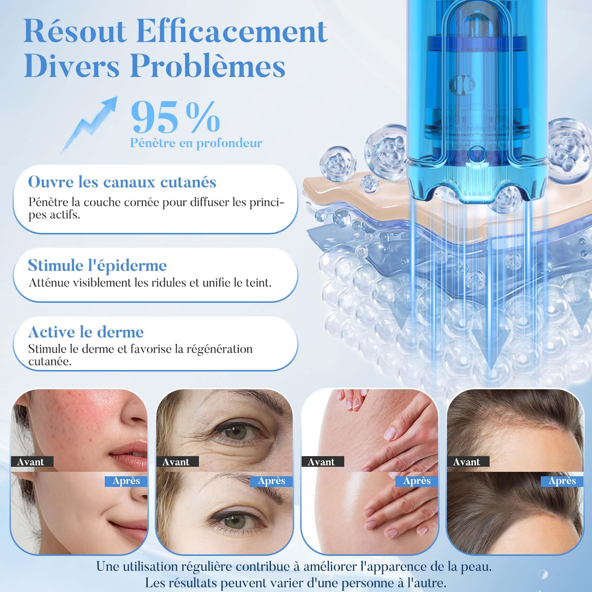 Dr. pen M9 Stylo Microneedling avec 10 Cartouches, Nouveau Modèle 2026, 6 Niveaux et Affichage LED Dermapen avec Base de Rangement, pour Visage Corps Cheveux Barbe Croissance