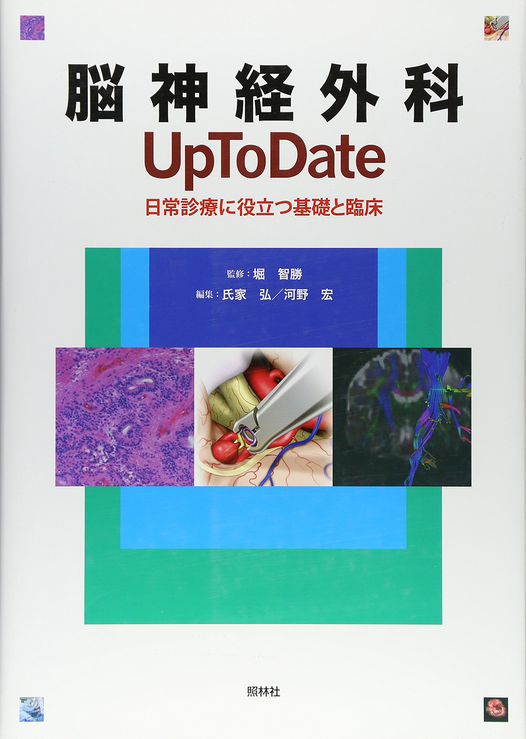脳神経外科 Up To Date: 日常診療に役立つ基礎と臨床 | 堀智勝, 氏家弘