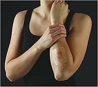 Vista 10 de Nexcare Tegaderm, apósito transparente, H1626, paquete de de 1, 1, 1