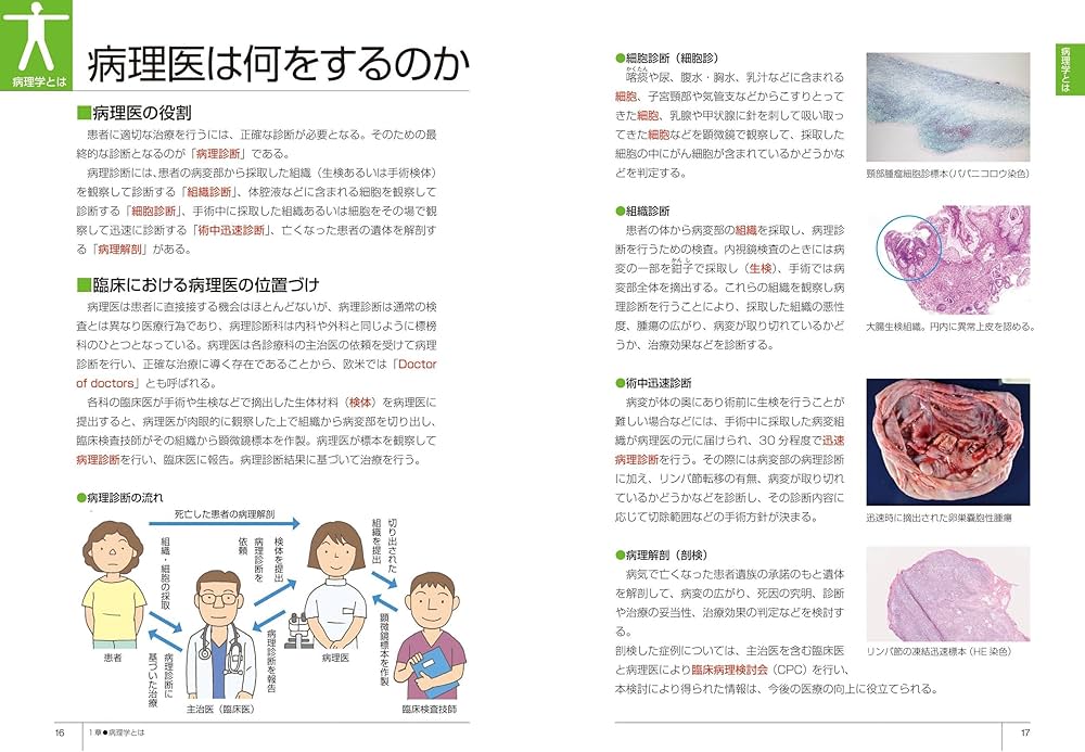 81ng03SKL9L._AC_UF1000,