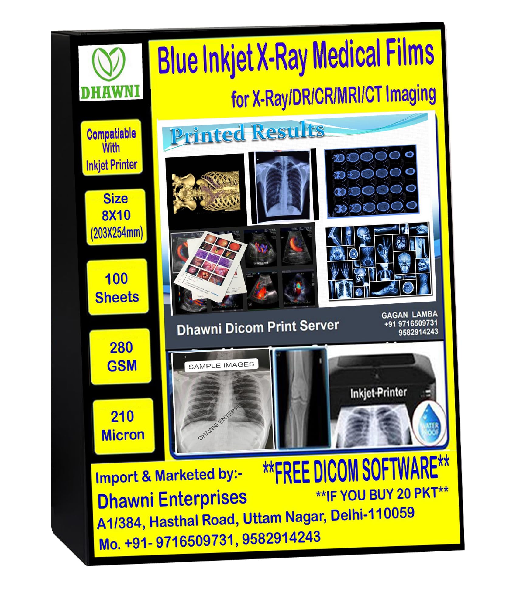 Dhawni Xray Blue Inkjet Medical Film for X Ray Imaging Waterproof Film (8 inch X 10 inch) 100 Sheet 280 GSM / 210 Micron