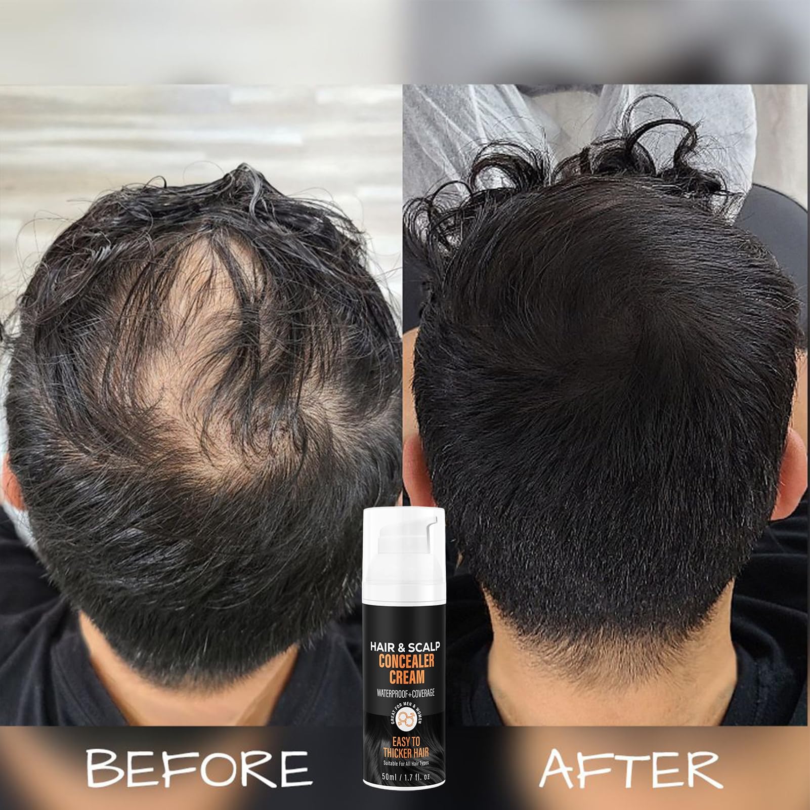 Pelliccia per cuoio capelluto, crema di riempimento per zone calve – Crema naturale per radici 50 ml per capelli più pieni e maggiore densità di attaccatura dei capelli in uomini e donne