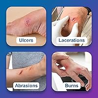 Vista 8 de AG Silver - Apósito para heridas de alginato de calcio, 2 x 2 pulgadas, 10 almohadillas estériles, antiadherentes y altamente absorbentes