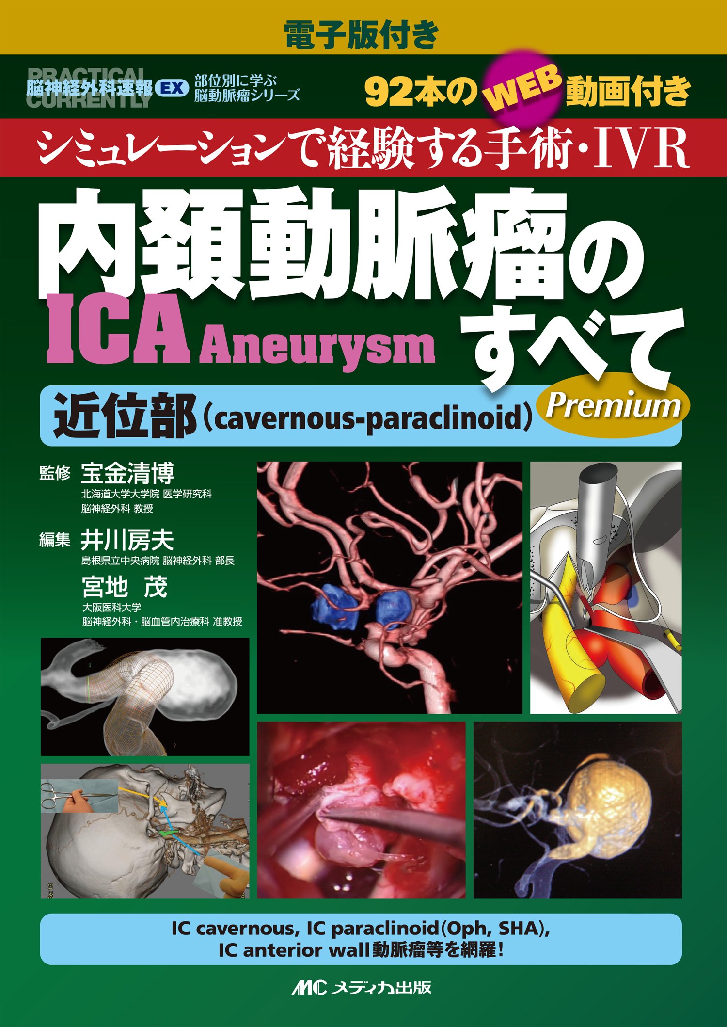 電子版付き 内頚動脈瘤(ICA Aneurysm)のすべて-近位部(cavernous