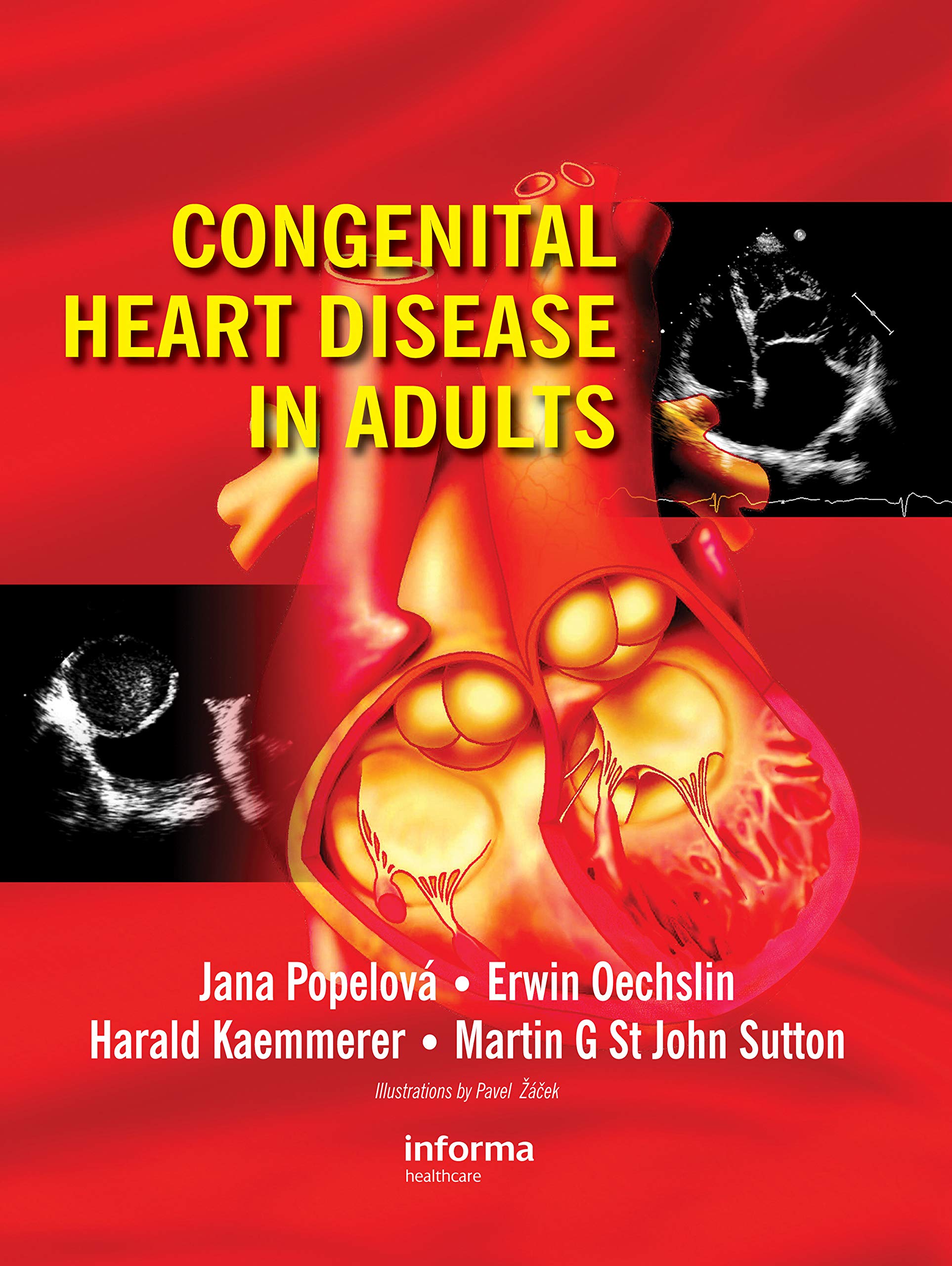 Congenital Heart Disease in Adults (English Edition)