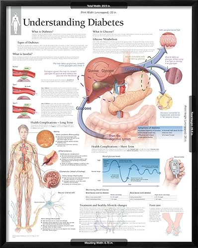 Miniatura 5 de AllPosters Póster de pared para entender la diabetes, gráfico educativo sobre marco negro, 22 x 28 pulgadas