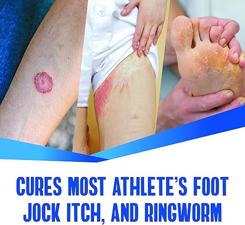 Miniatura 5 de Natureplex Pro-Ex Crema Antifúngica 1% Clotrimazol (paquete de 5) – Extra Fuerza Jock Itch, Tratamiento de Pie de Atleta y Tiña, fabricado en