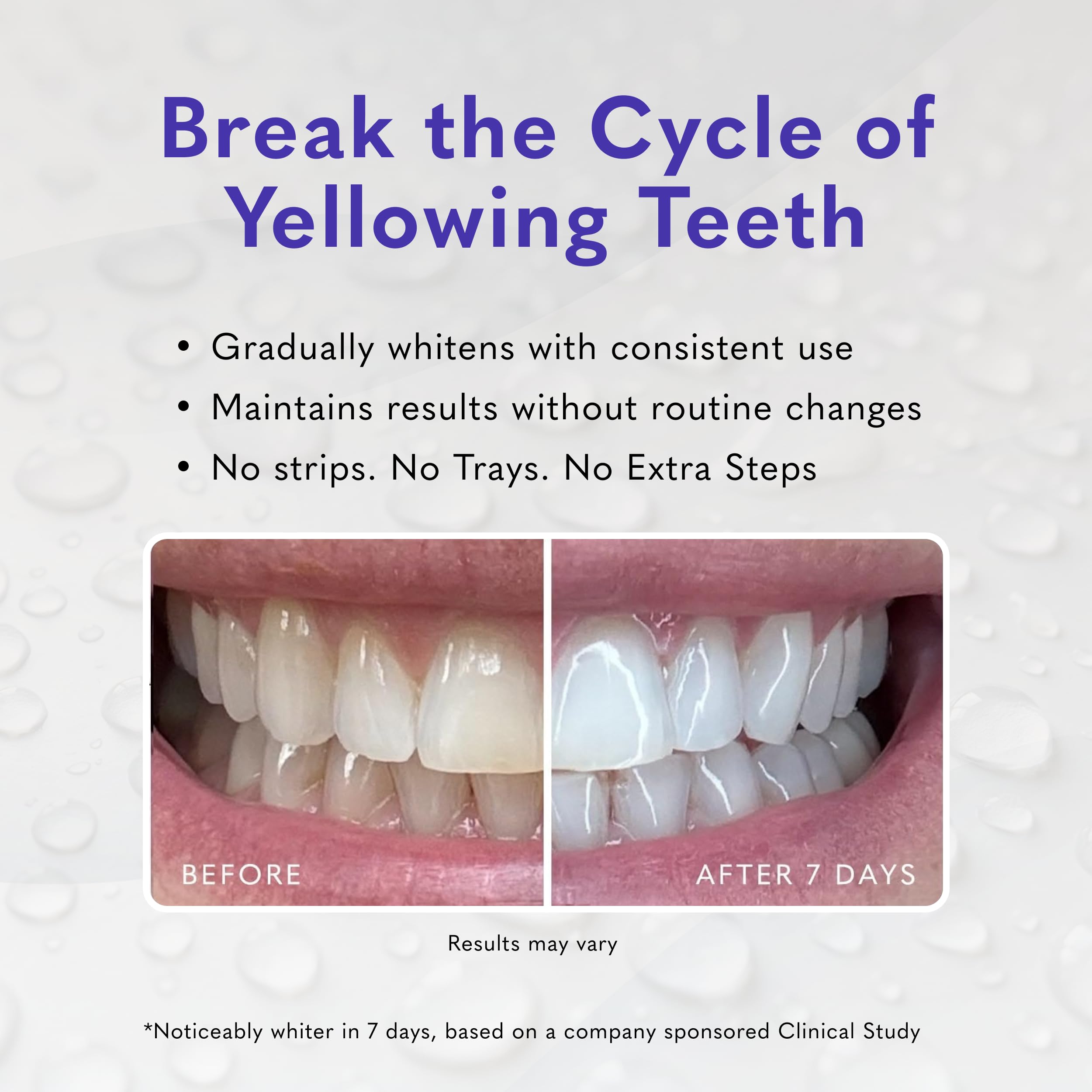 Smileactives Teeth Whitening Gel - Whiter Smile! -7