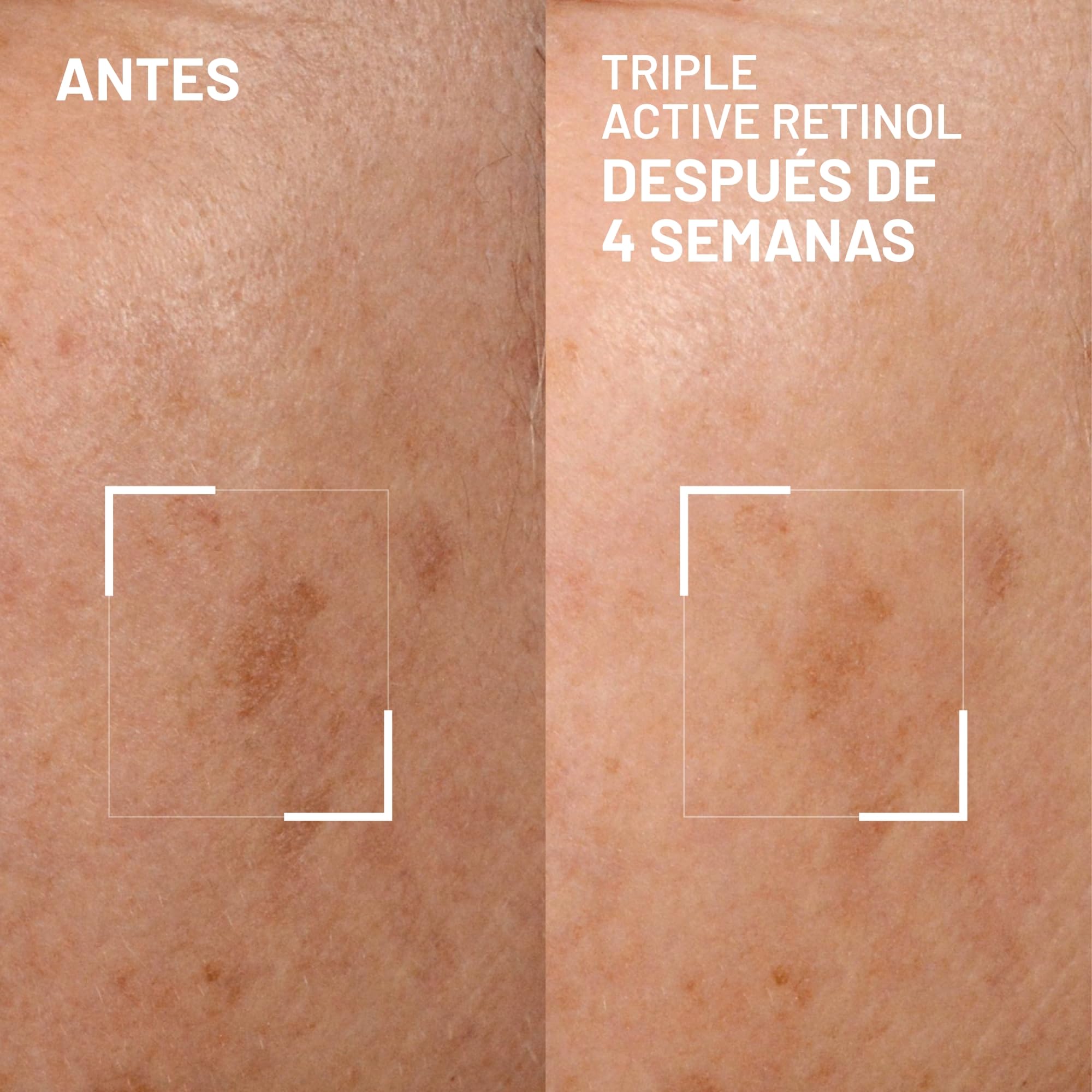 Bright This Way Triple Active Retinol del Dr. Brandt - Crema Renovadora Suave Para la Noche - Reduce Las Arrugas y La Decoloración, Ilumina e Hidrata - 30 ml