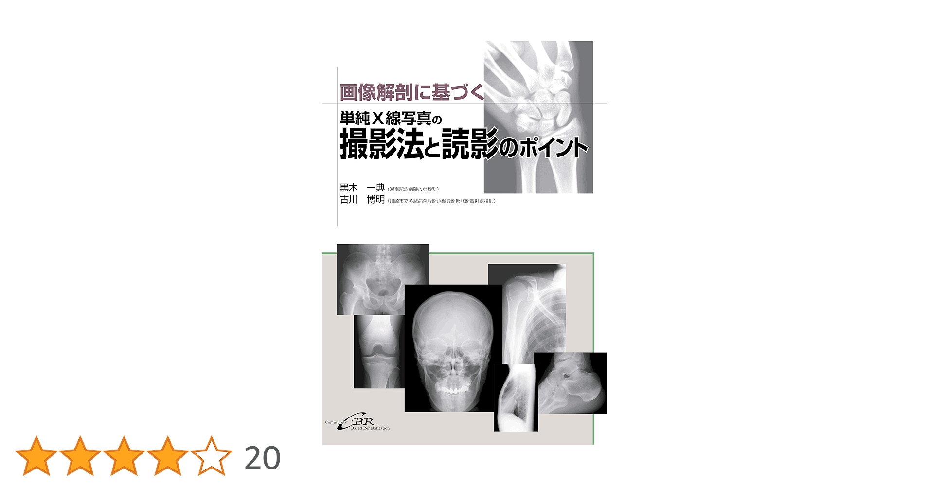新・図説単純X線撮影法: 撮影法と診断・読影のポイント 41nuTaa-dpL.jpg_BO30,255,255,