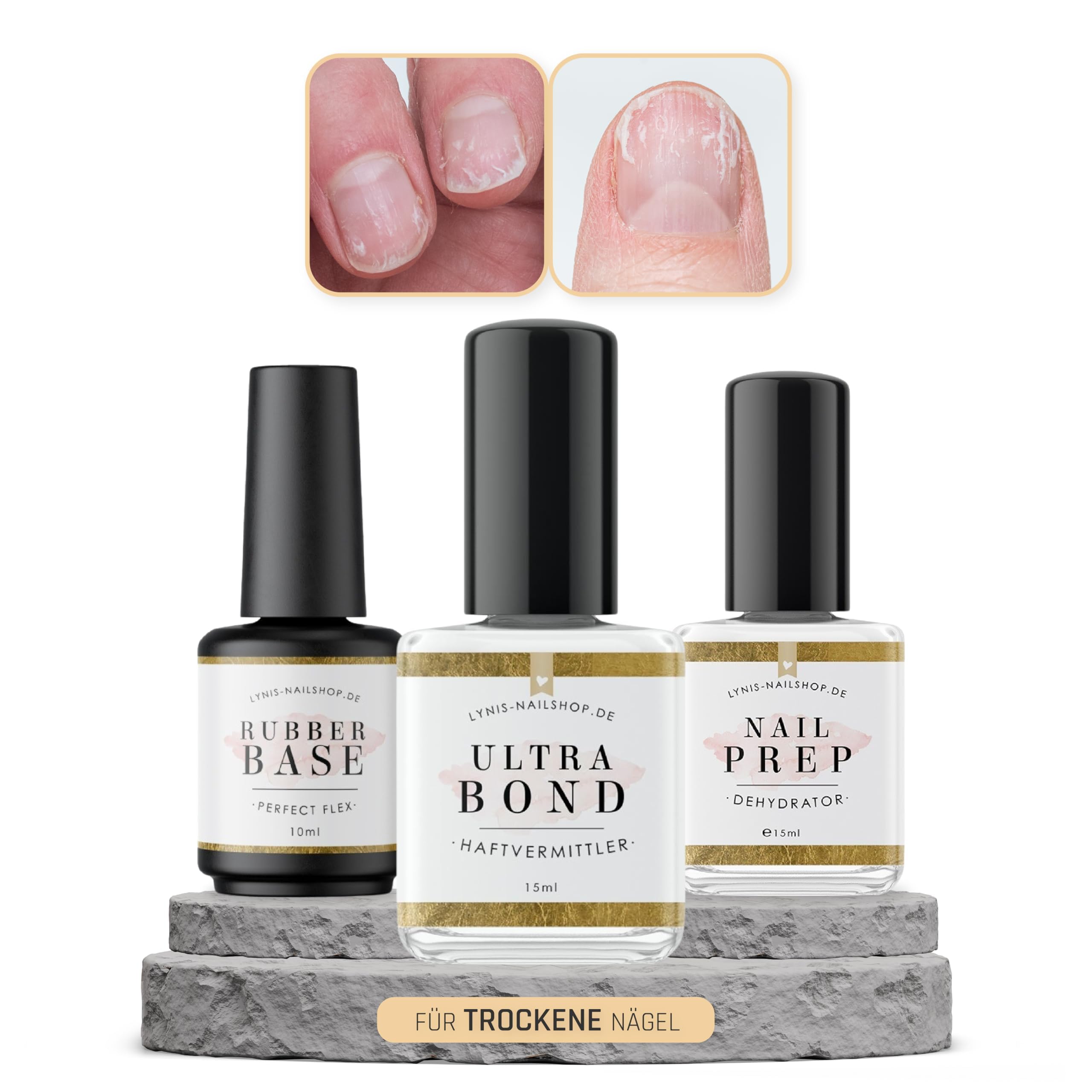 Ultra Bond Set für TROCKENE/SPRÖDE Nägel für wenige Liftings mit Ultra Bond, Dehydrator & Perfect Flex für Kunstnägel, Lynis-Nailshop.de