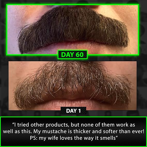 Beard Growth Kit w/Maximum Strength 14-in-1 Beard Growth Vitamins & Hair Vitamins Gummies + 6X Liquid Biotin with Collagen Peptides + 2X Biotin Mustache Wax & Balm for Men - Formulated in America
