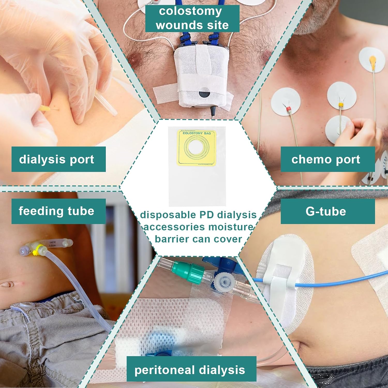 50 PCS Peritoneal Dialysis Shower Pouch, Waterproof Dialysis Catheter Shower Cover for Dialysis Port, Chemo Port, Picc Line, Chest Catheter, Feeding Tube Supplies, PD Peritoneal Dialysis Accessories