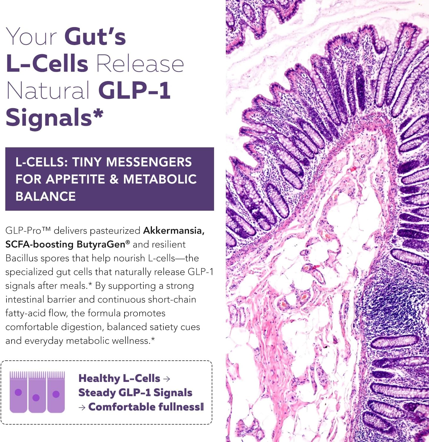 GLP-Pro™: Probiotic & Postbiotic Blend for Natural GLP-1 Support — Akkermansia MucT™, ButyraGen® Butyrate Generator & Spore Bacillus — Healthy Appetite, SCFA & Metabolic Balance — 30 Count - Image 3