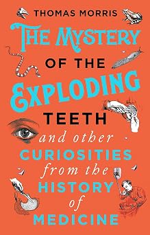 The Mystery of the Exploding Teeth and Other Curiosities from the History of Medicine