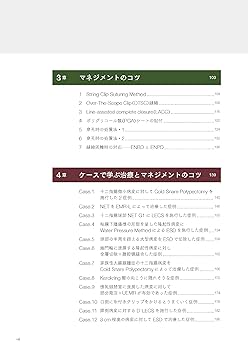 Amazon.co.jp: 十二指腸腫瘍の内視鏡治療とマネジメント : 小山