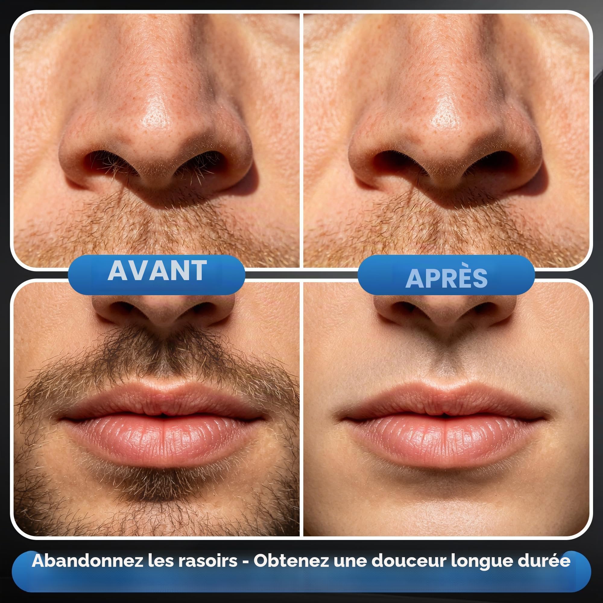 Foneso Cire Epilation Nez Kit pour Hommes et Femmes | Épilateur pour poils du nez, oreilles et sourcils | Réchauffeur portable à chauffe rapide USB-C, perles de cire et applicateurs