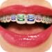 Teeth Braces Booth