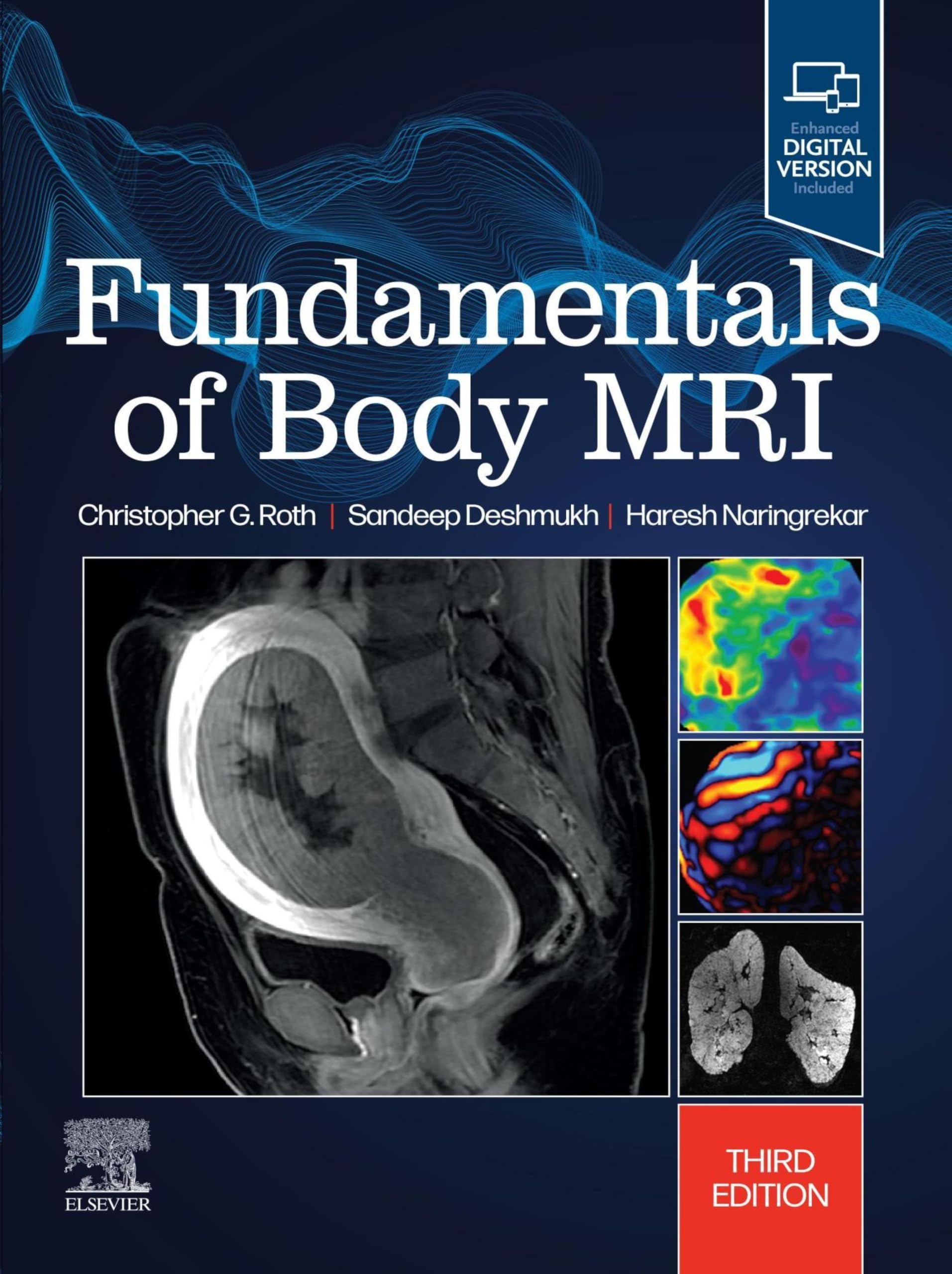 Fundamentals of Body MRI E-Book (Fundamentals of Radiology) (English Edition)