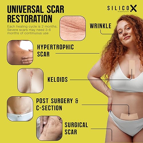 Miniatura 3 de Cinta de silicona para cicatrices de grado médico y hojas de cicatrices para recuperación de cicatrices, kits de viaje con cinta de cicatrices (1.5