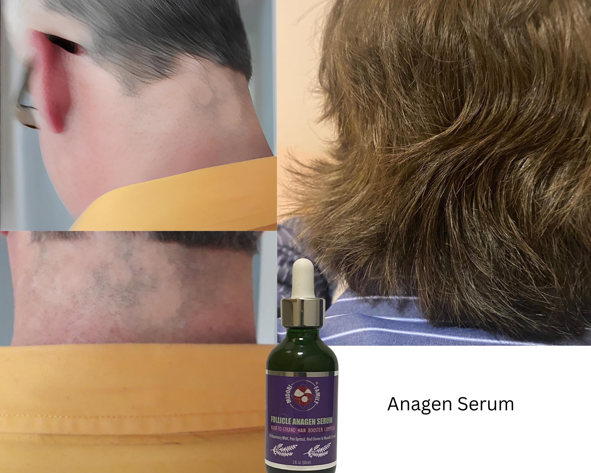 ボディローション advangen scalplotion haircycle care 28mL Amazon.com : Follicle Anagen Hair Serum Concentrate - For Hair