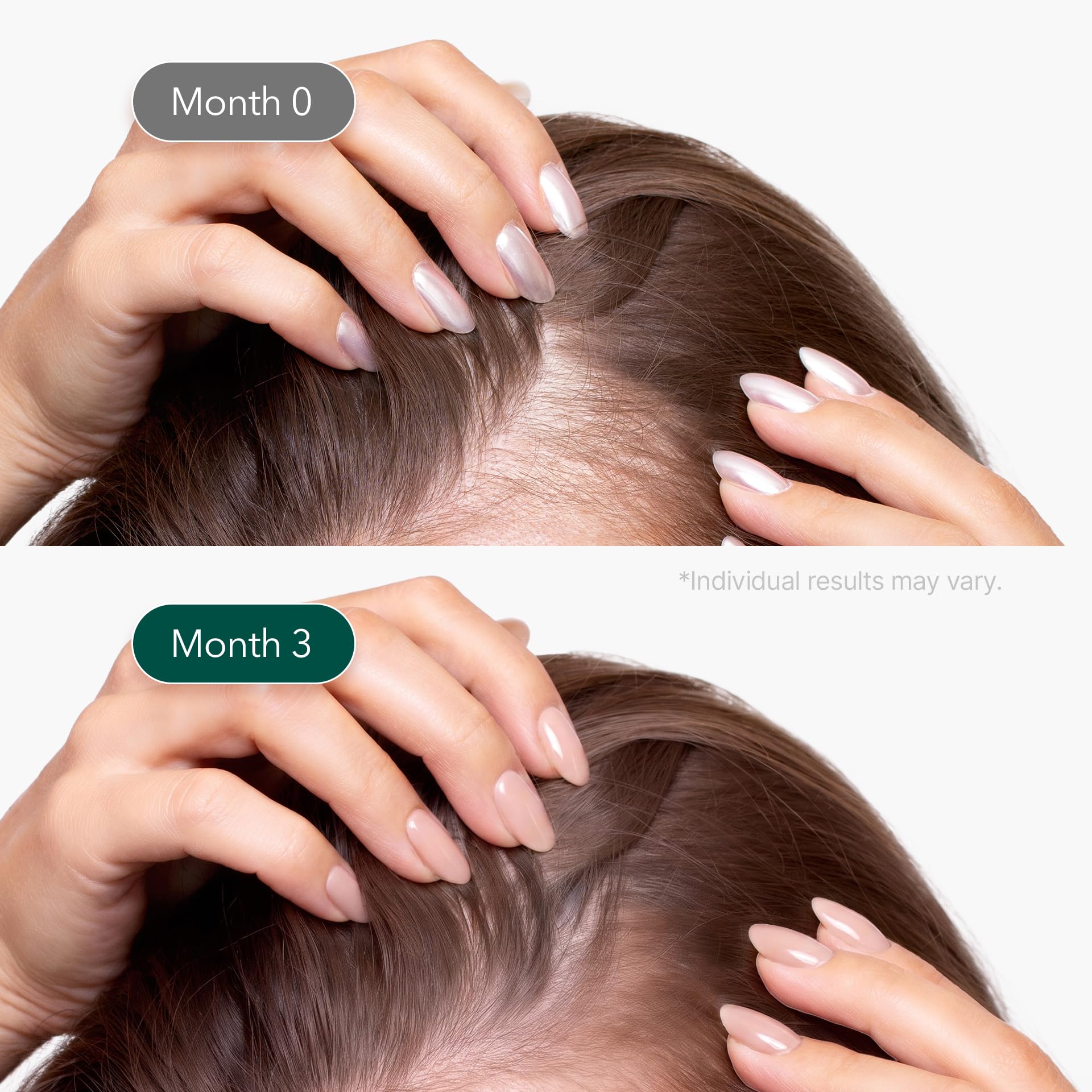 ViveLab Micro Foam Scalp Treatment with Biotin, Rosemary Oil & Caffeine