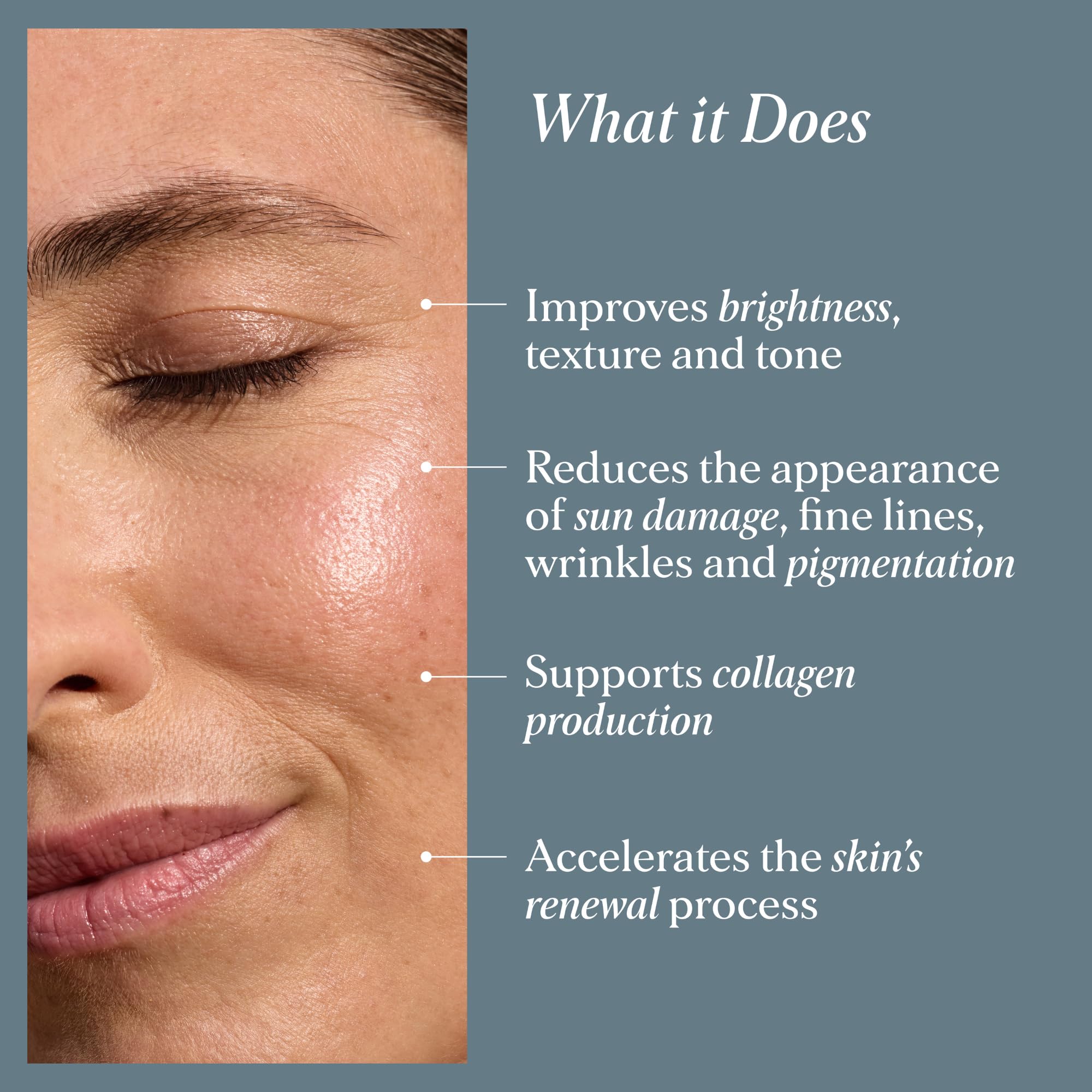 Alpha-H Liquid Gold Exfoliating Treatment 5% Glycolic Acid 100ml - Brighten, Even Tone, Smooth Texture, Reduce Appearance of Fine Lines - At-Home Skin Renewal for All Skin Types