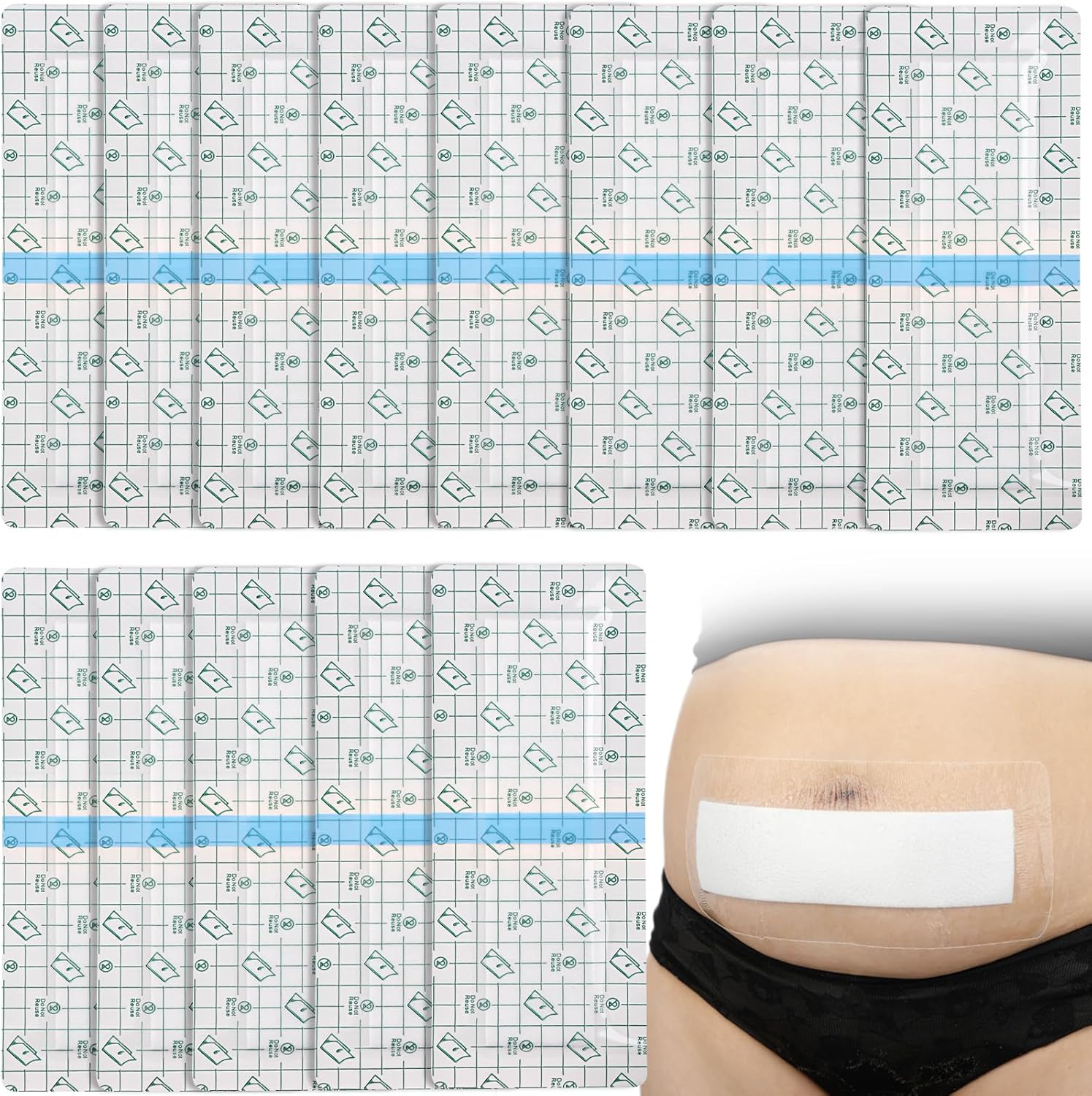25 Pcs Waterproof CSection Incision Shower Protector