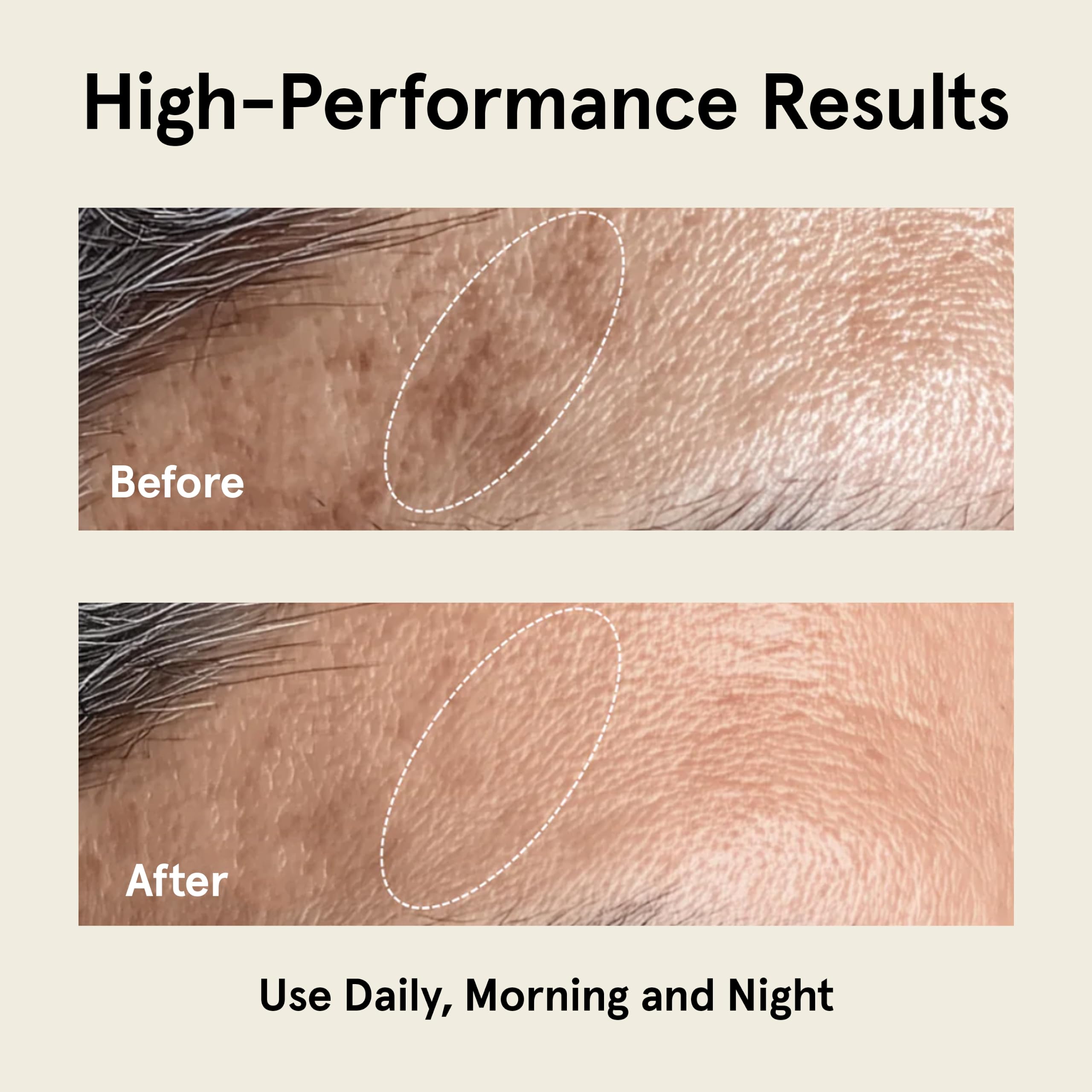 Super serum przeciw starzeniu się skóry na twarz: 5% serum niacynamidowe, bakuchiol, serum z witaminą C do twarzy, serum dla mężczyzn, kwas traneksamiczny, hiperpigmentacja, usuwanie ciemnych plam,