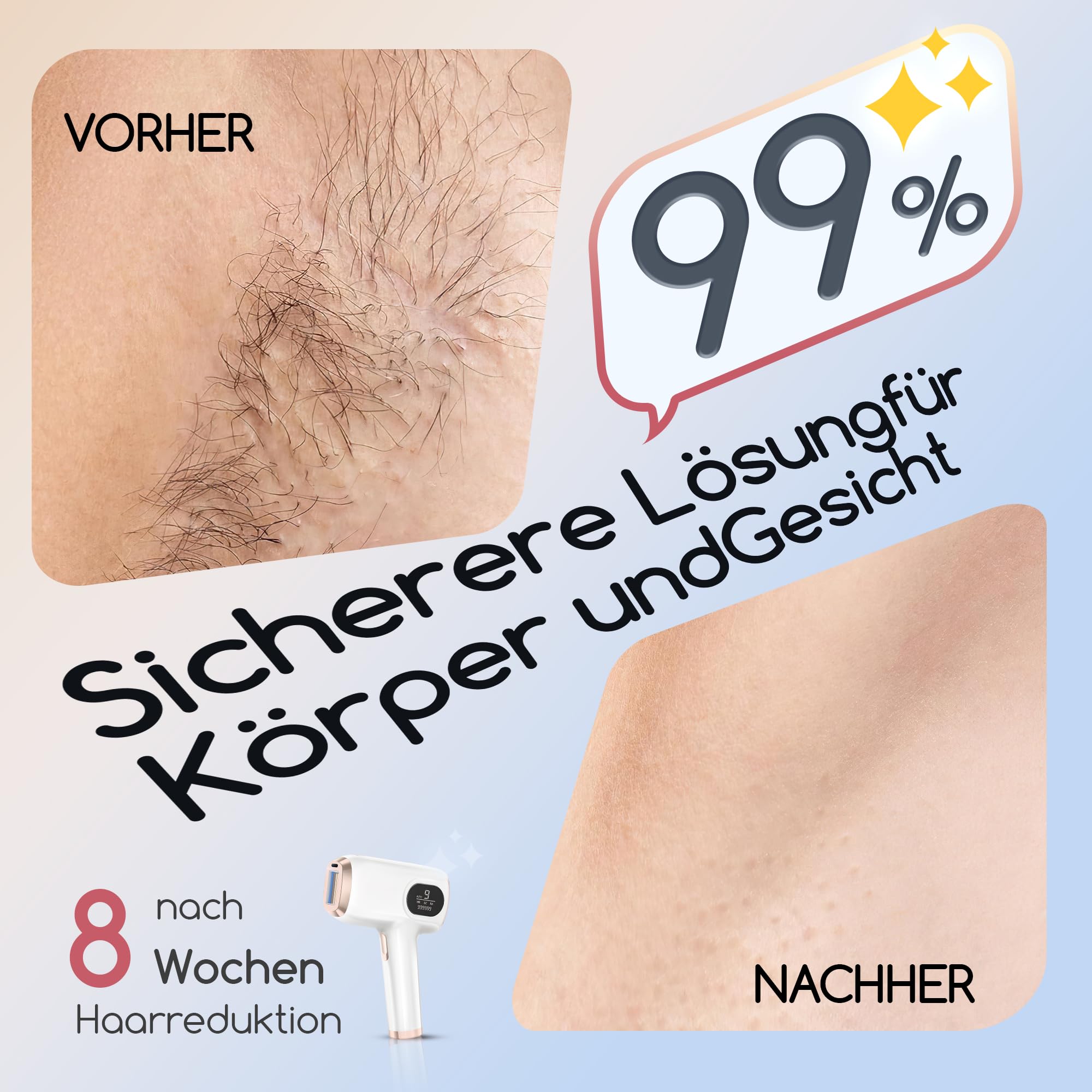 IPL Geräte Haarentfernung, Laser Haarentfernung, mit 3 Erweiterte Funktionen HR/SR/HR+,9 Energiestufen,999,999 Lichtimpulse für Männer,Frauen,Ideal für Gesicht,Körper