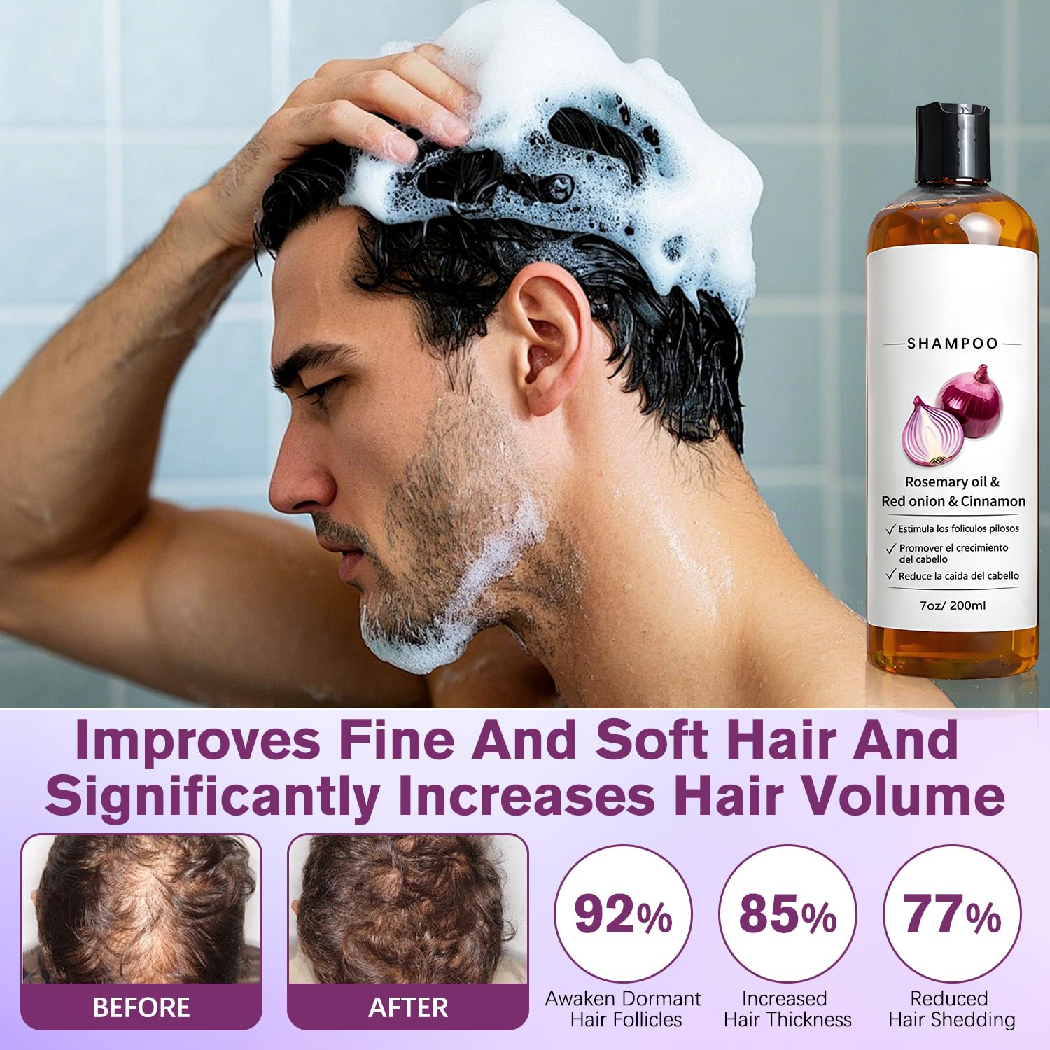 Shampoo De Cebolla, Shampoo Para Hombre with Rosemary Oil & Red Onion & Cinnamon Ex... - Image 2