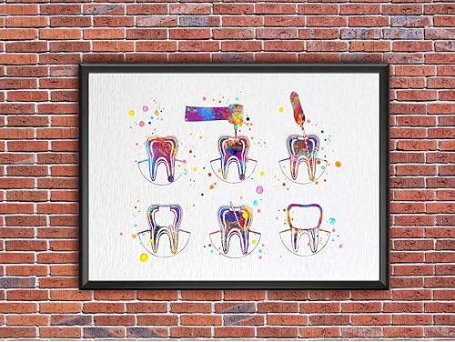 Miniatura 9 de Dignovel Studios 8X10 sin marco Endodoncia Terapia Tratamiento Dental Acuarela Arte Impresión Tratamiento de conducto radicular Clínica Dental