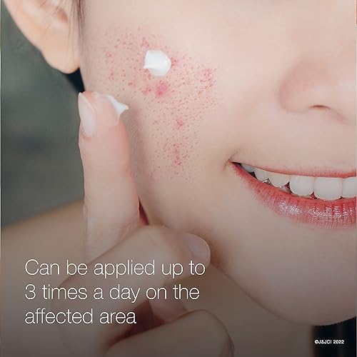 Miniatura 9 de Neutrogena Rapid Clear - Gel de tratamiento de manchas para el acné con máxima resistencia al 10 de peróxido de benzoílo medicamento para