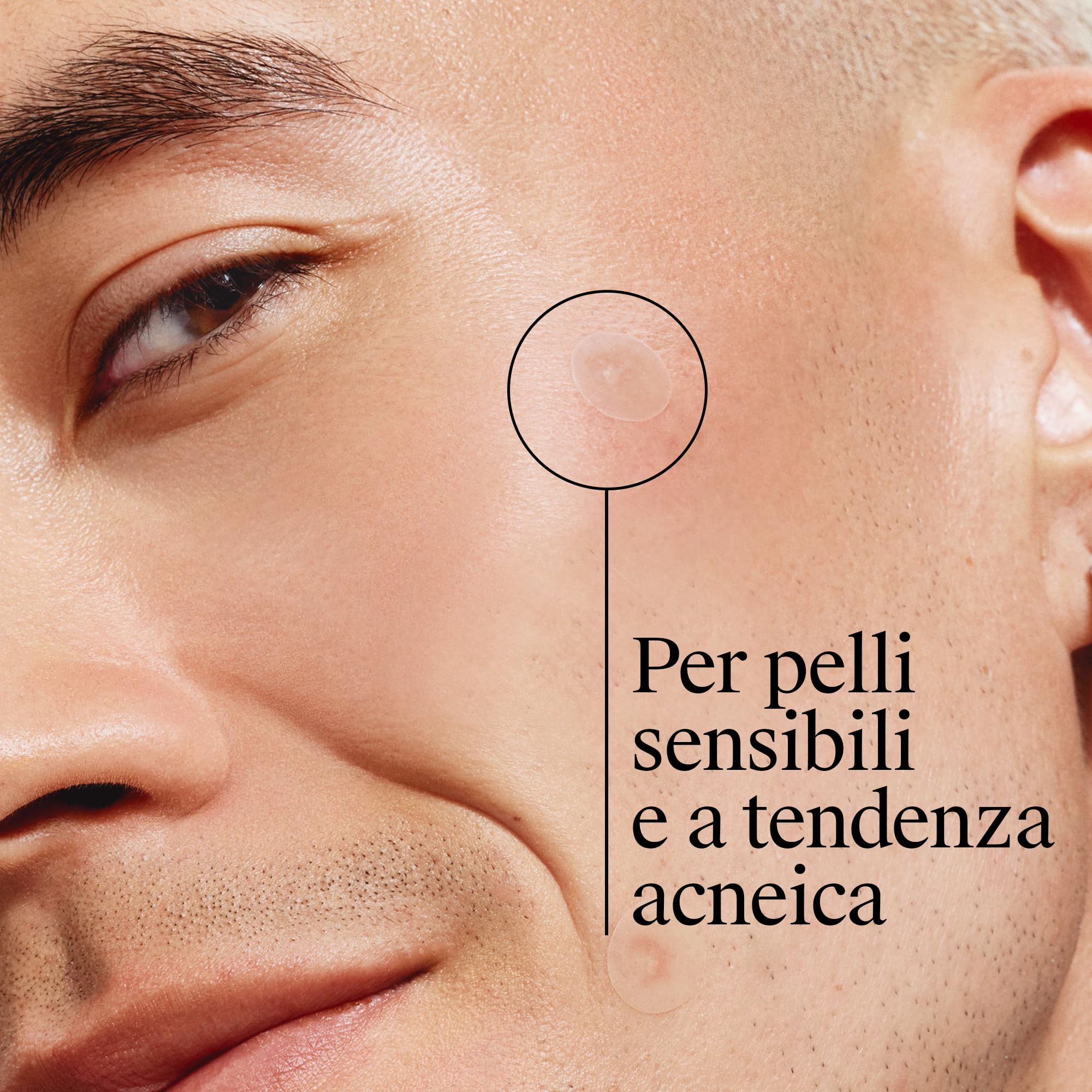 Neutrogena Clear & Defend+ Cerotti per Imperfezioni 30 pezzi, Patch brufoli idrocolloidali anti-imperfezioni, Cerotti brufoli per tutti i tipi di pelle, Pimple patches anti-acne delicati