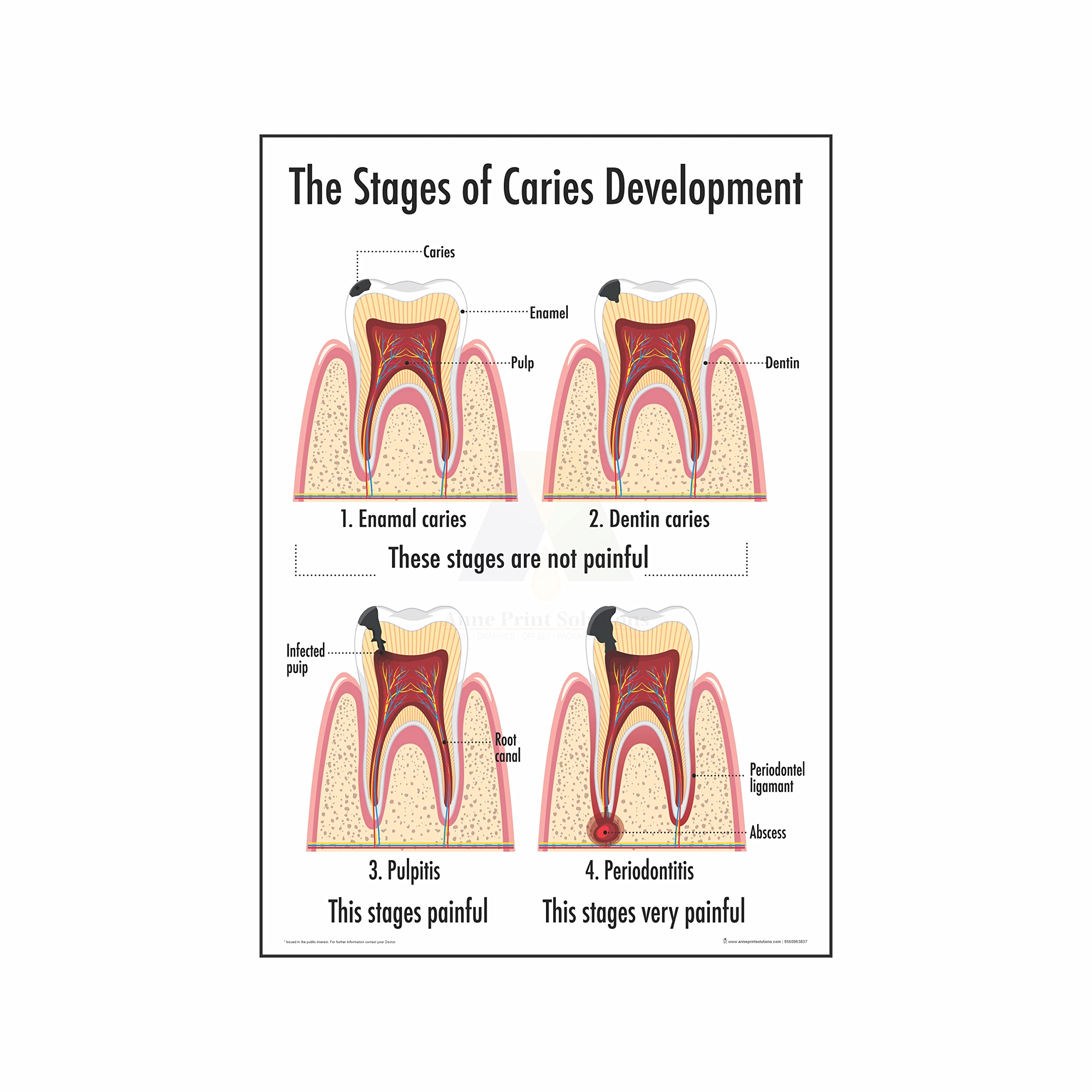 Dental Implant Chart Poster - Healthcare Reference -13